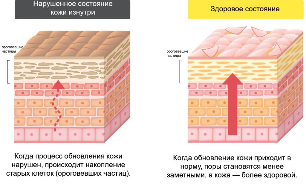 One By Kose Clear Peel Serum Pore Refiner-7.jpg