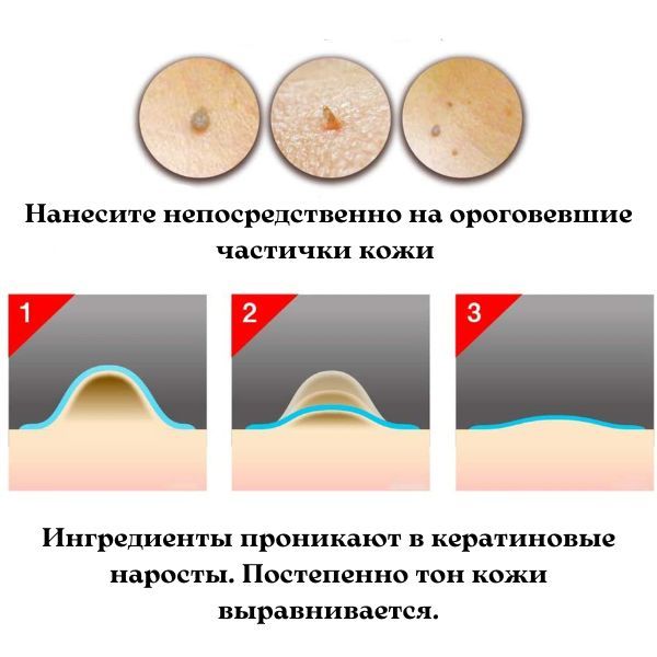 Ipocare EX Essence-1.jpg