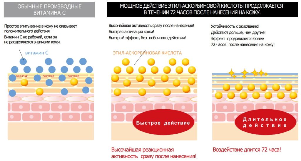 pigmentaciya-3.jpg