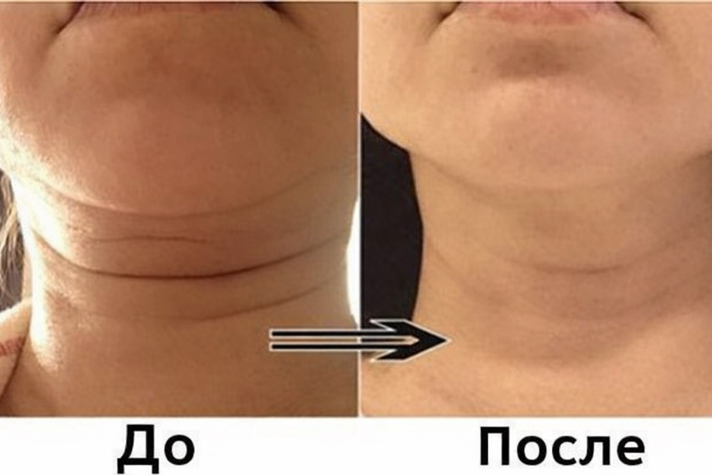 qubi-neck-stretching-cream-3.jpg
