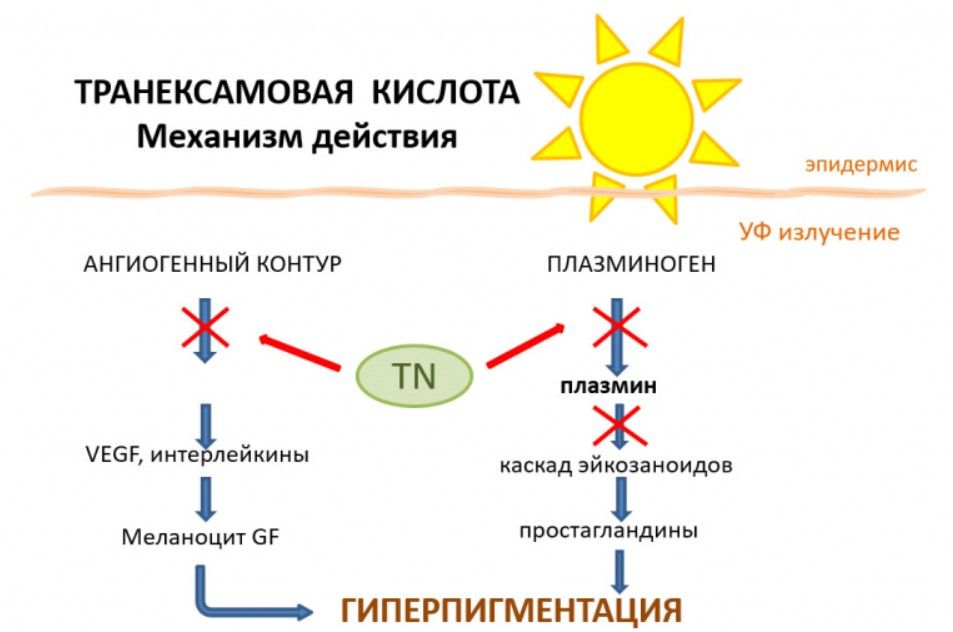 pigmentaciya-2.jpg
