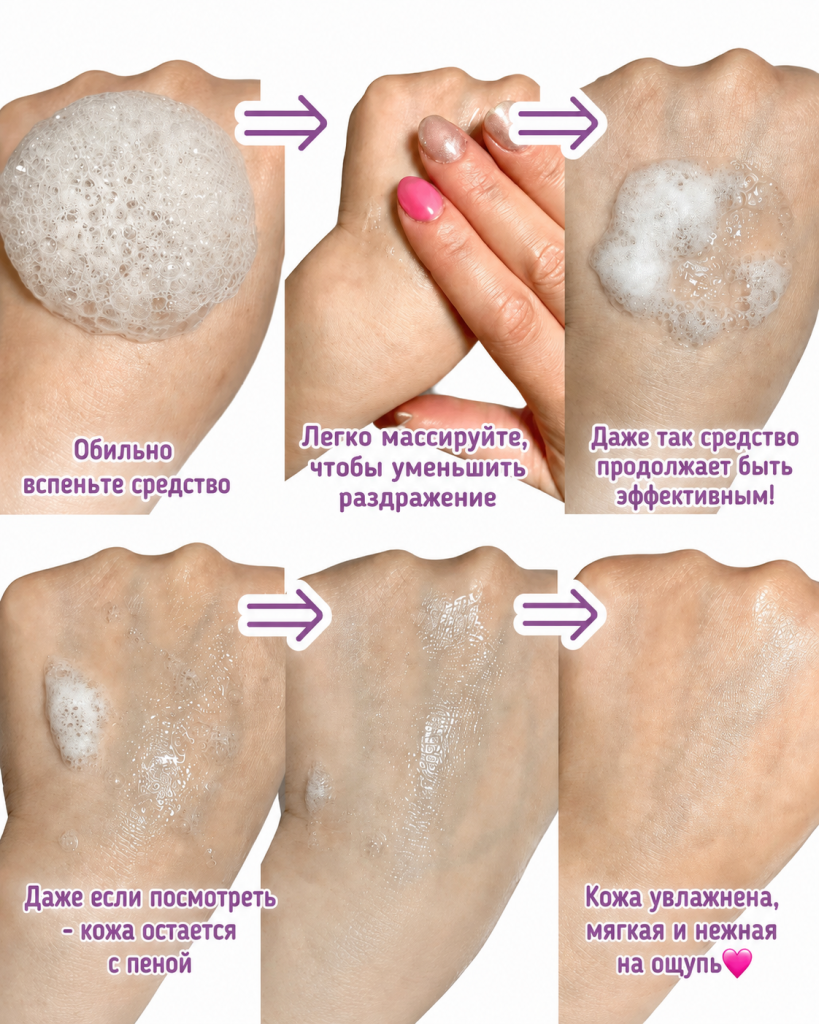 seins_mous_cracking_w_exosome_6.png