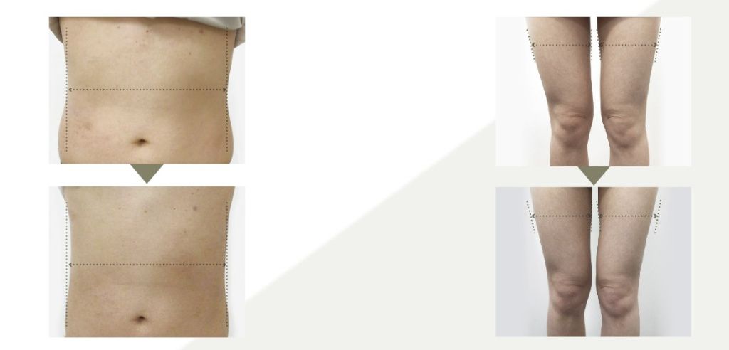 Shinbishin Slimuscle Fit Face And Body Cream-8.jpg