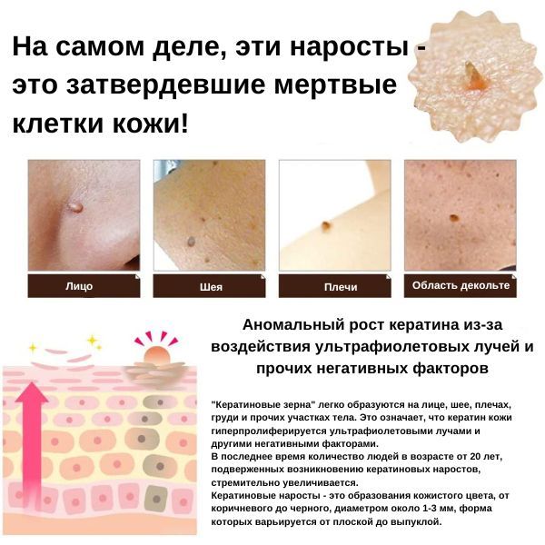 Ipocare EX Essence-2.jpg