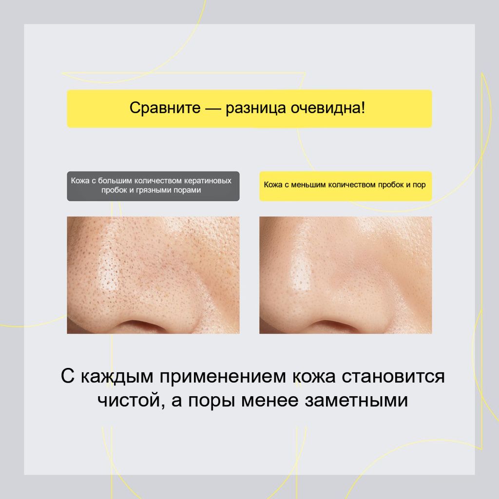 One By Kose Clear Peel Serum Pore Refiner-5.jpg