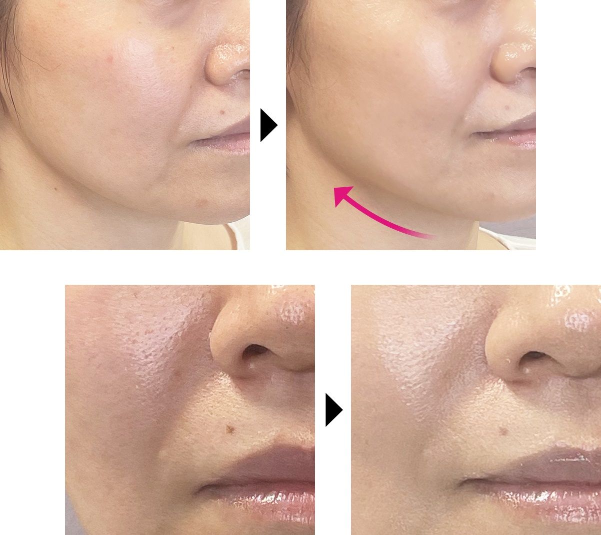 Антивозрастной тональный кушон для лица с лифтинг эффектом на 8 часов AMARANTH Dr.Soie 5G Lift Foundation — купить в Japrise Антивозрастной тональный кушон для лица с лифтинг эффектом на 8 часов AMARANTH Dr.Soie 5G Lift Foundation — фото товара Dr. Soie